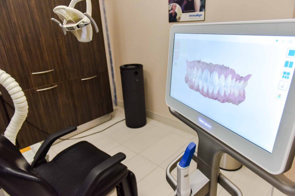 iTero Digital Scans | Lifestyle Dentistry | Family & General Dentist | Mississauga | Ontario