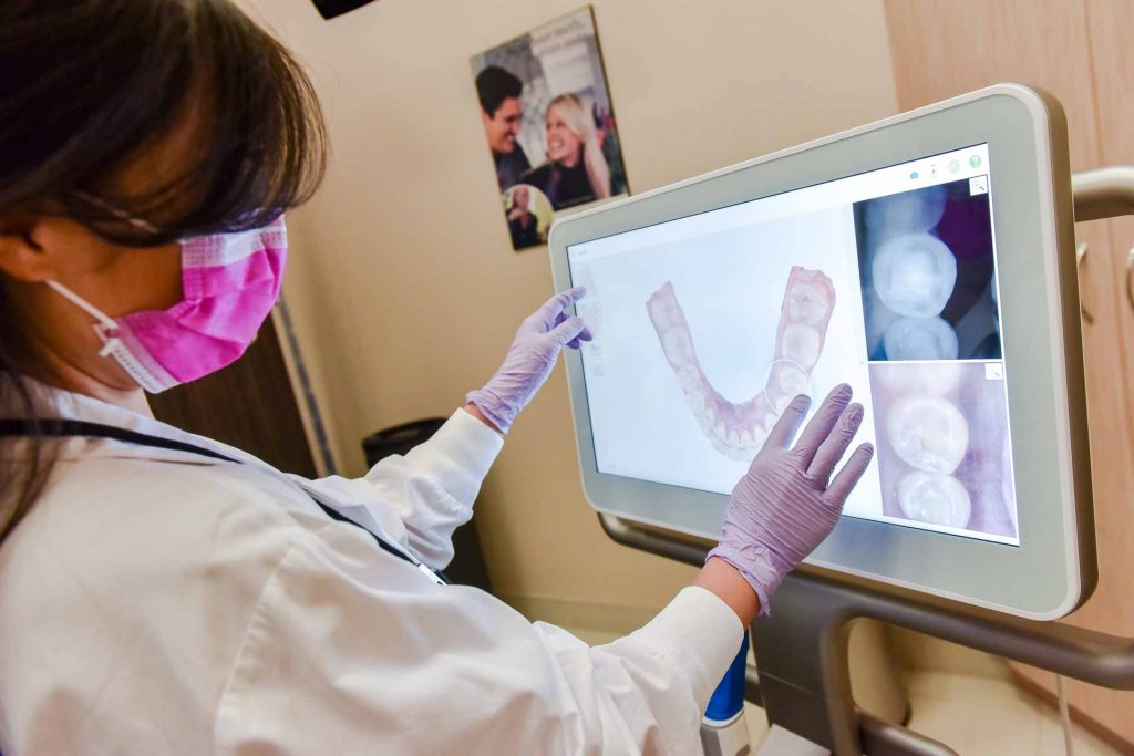 Mississauga iTero Digital Scan | Lifestyle Dentistry | Family & General Dentist Mississauga, ON