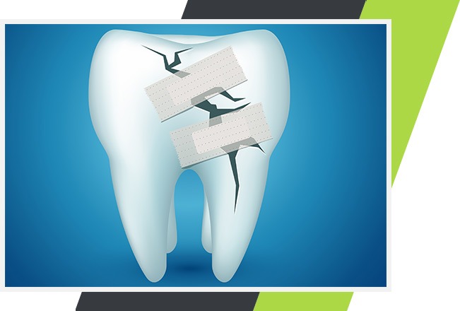 Mississauga Root Canal Therapy | Lifestyle Dentistry | Family & General Dentist