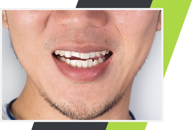 Orthodontics | Lifestyle Dentistry | Family & General Dentist | Mississauga | Ontario
