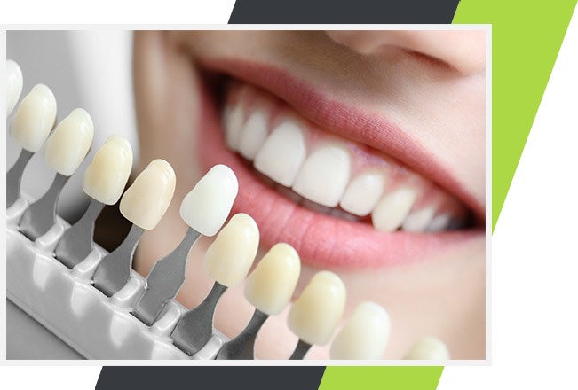 Porcelain Veneers | Lifestyle Dentistry | Family & General Dentist | Mississauga | Ontario