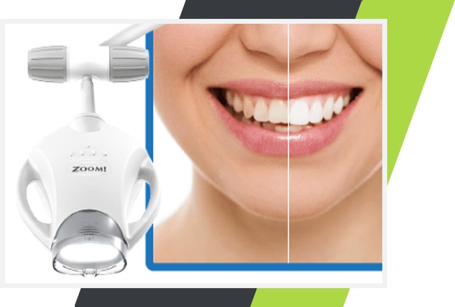 Zoom Teeth Whitening | Lifestyle Dentistry | Family & General Dentist | Mississauga | Ontario