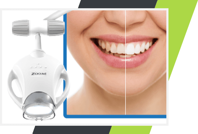 Zoom Teeth Whitening | Lifestyle Dentistry | Family & General Dentist | Mississauga | Ontario